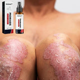 KOLMAX™ SPRAY PARA TRATAMIENTO DE PSORIASIS