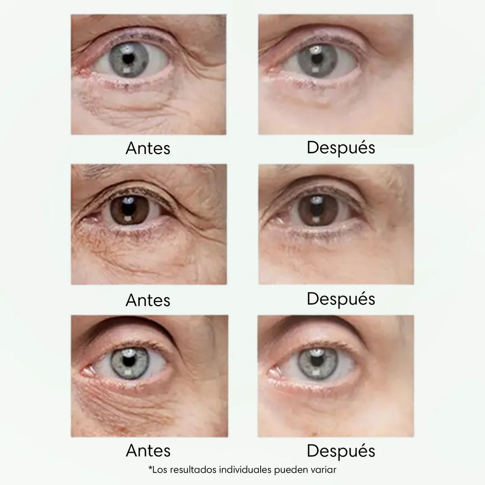 CELYN Crema reafirmante para zona de los ojos, eliminación de arrugas y ojeras