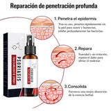 KOLMAX™ SPRAY PARA TRATAMIENTO DE PSORIASIS