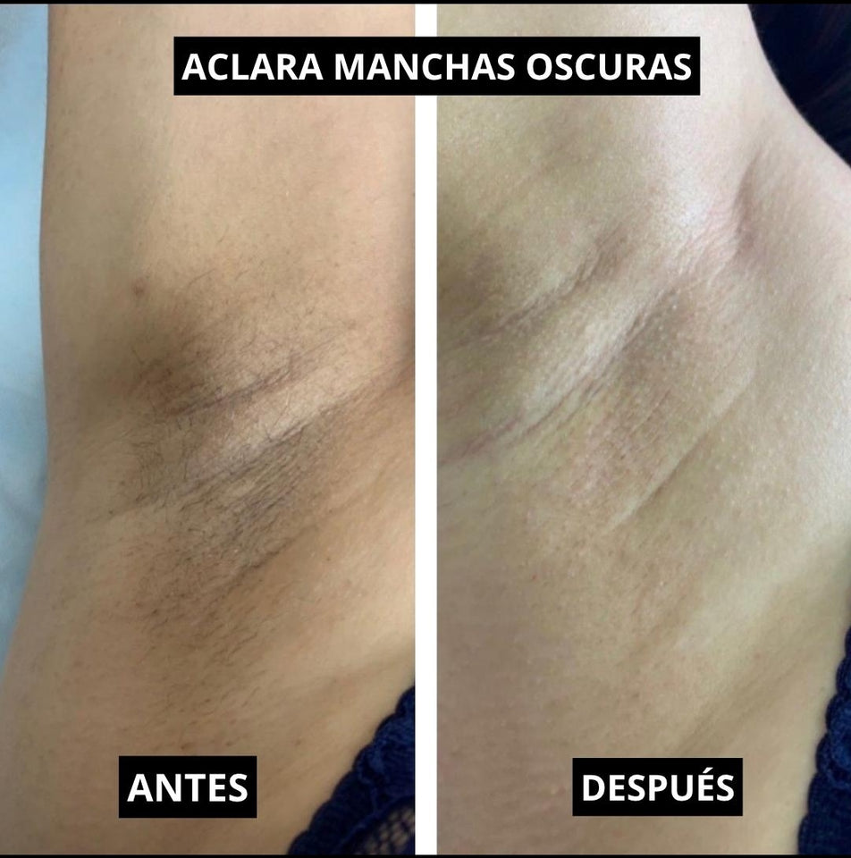 LOCION CORPORAL ACLARANTE  GLUTATHION- NIACINAMIDA  12.5%