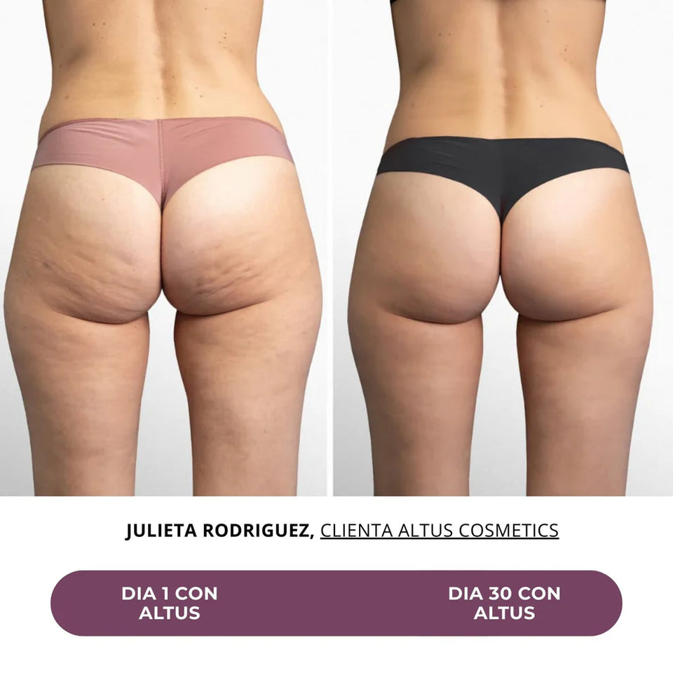ALTUS CREMA ANTICELULITIS