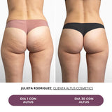 ALTUS CREMA ANTICELULITIS