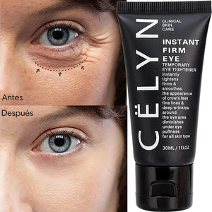 CELYN Crema reafirmante para zona de los ojos, eliminación de arrugas y ojeras